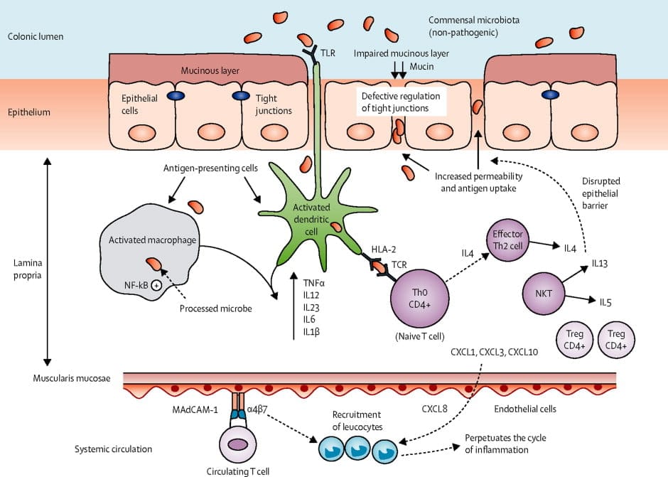 Ulcerative Colitis Immunology Drugs Market is Set To Fly High in Years ...