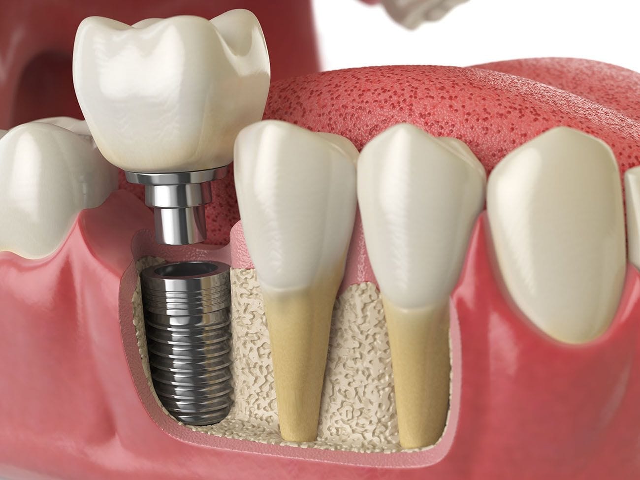 Tooth Regeneration Market