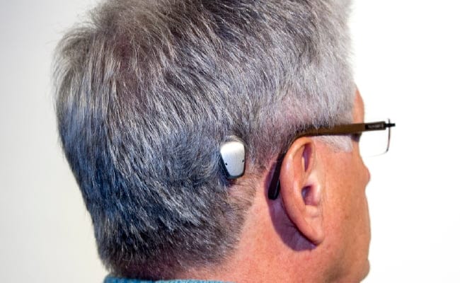 Bone Conduction Device Bone Conduction Implants Market Projected to Show Strong Growth - Newstrail