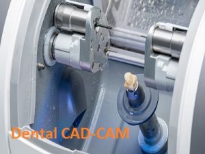 Dental CAD-CAM Market