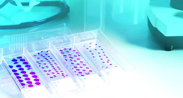 Tissue Diagnostic Market