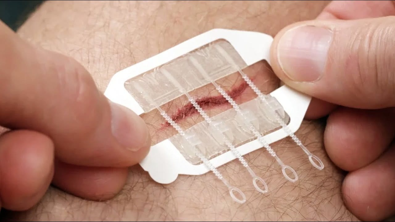Wound Closure Market