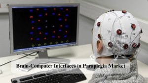 Brain-Computer Interfaces in Paraplegia Market, Brain-Computer Interfaces in Paraplegia Market Size, Brain-Computer Interfaces in Paraplegia Market Share