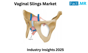 Vaginal Slings Market