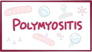 Pyomyositis Market