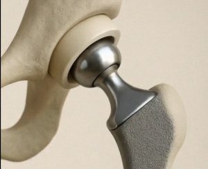 Orthopaedic Casting Materials Market