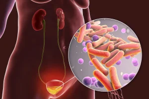 Uncomplicated Urinary Tract Infection (UTI) Treatment Market