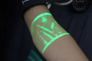 Vein Illuminator Market