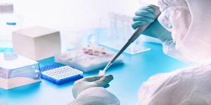 In-vitro Diagnostics Enzymes Market