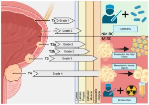 Non-muscle Invasive Bladder Cancer Therapeutics Market