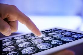 Clinical Trial Imaging Market