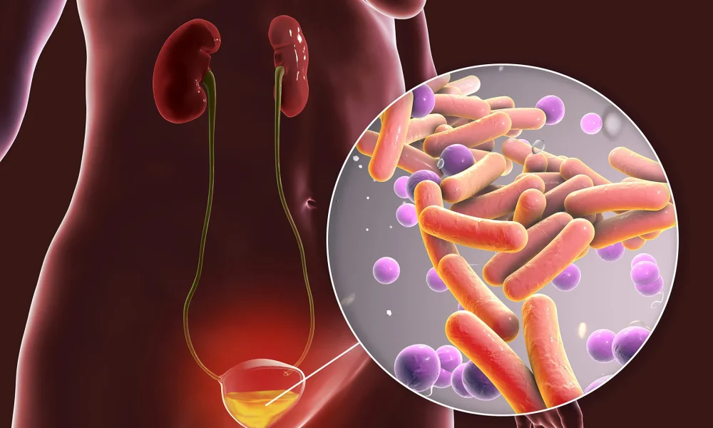 Uncomplicated Urinary Tract Infection (UTI) Treatment Market