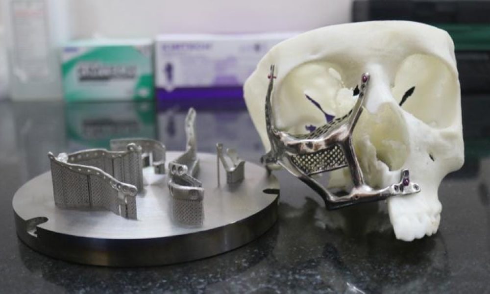 3D Printing Medical Implant Market