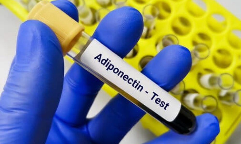 Adiponectin Testing Market