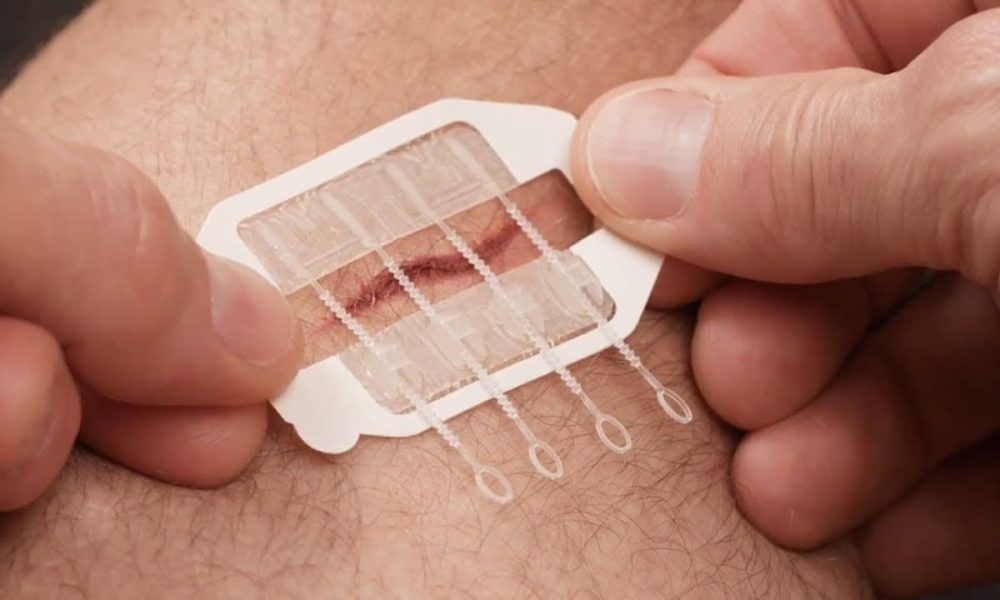 Advanced Wound Care Market