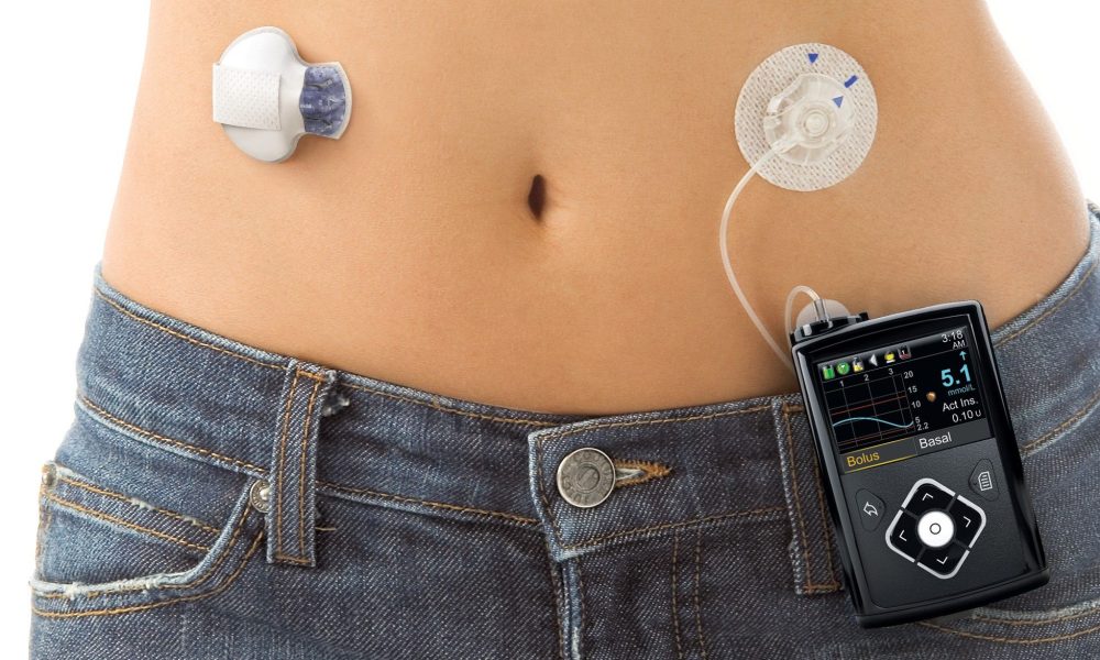 Artificial Pancreas Device Systems