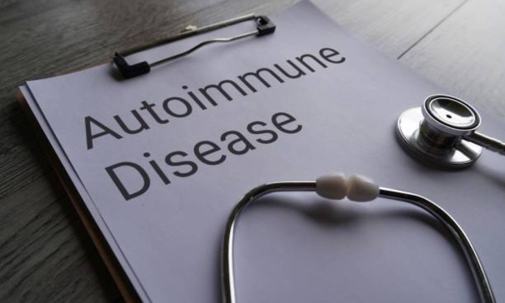 Closeup image of stethoscope and paper clipboard with text AUTOIMMUNE DISEASE. Medical and healthcare concept