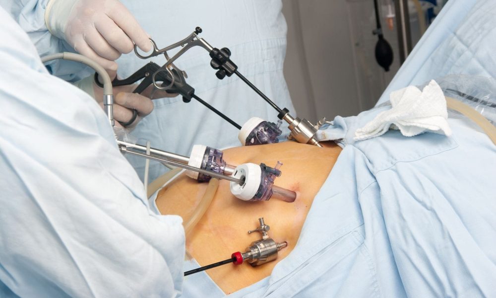 Bariatric Surgery Devices