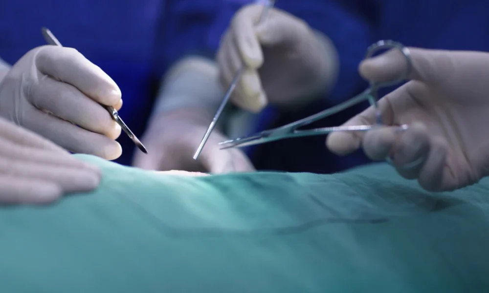 BioSurgery
