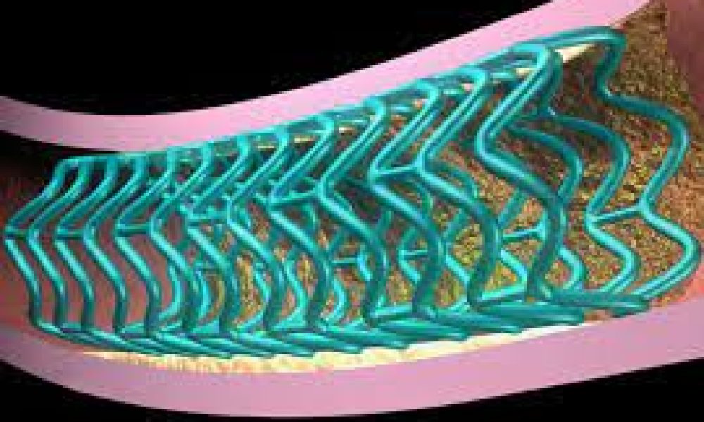 Bioresorbable Scaffolds Market