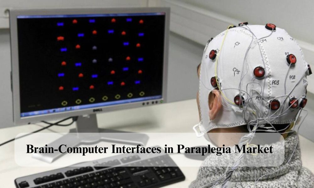 Brain-Computer Interfaces in Paraplegia Market, Brain-Computer Interfaces in Paraplegia Market Size, Brain-Computer Interfaces in Paraplegia Market Share