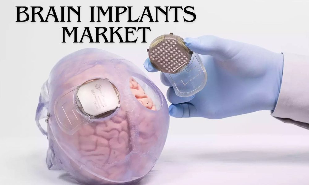 Global Brain Implants Market