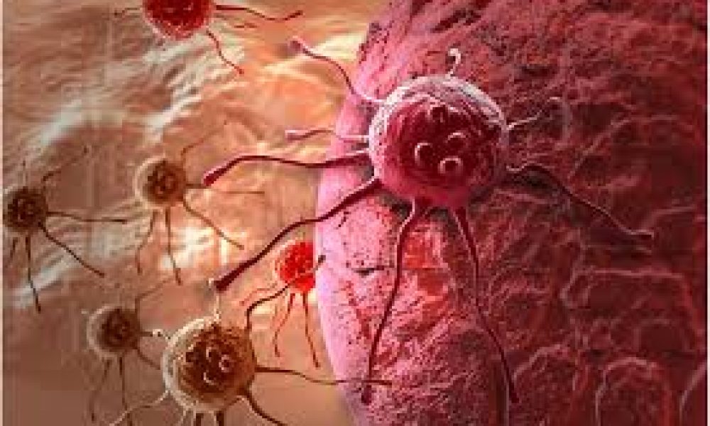 Cancer Imaging System