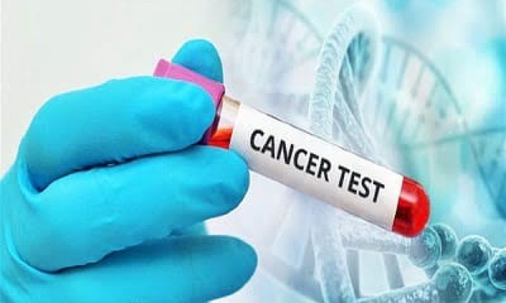 Cancer Test Market - A Story of Very Rapid Development| Beckman Coulter ...