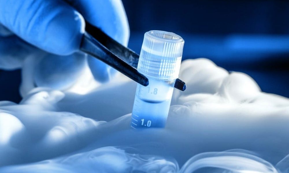 Cell Cryopreservation Market