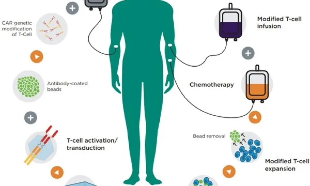 Cell Therapy Manufacturing