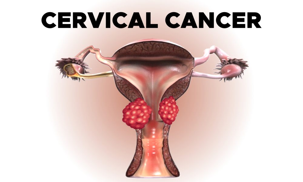 Cervical Cancer Diagnostic Testing