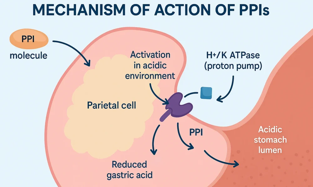 Proton Pump Inhibitors (PPI) Market