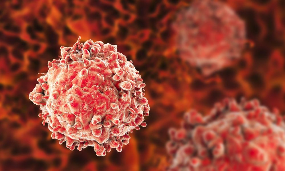 Chronic Lymphocytic Leukemia Therapeutics