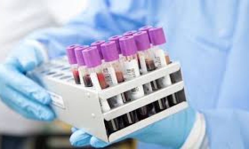Clinical Laboratory Tests Market
