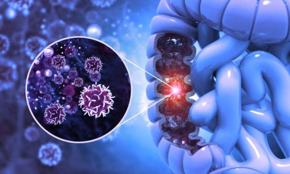 Colorectal Cancer Screening Market