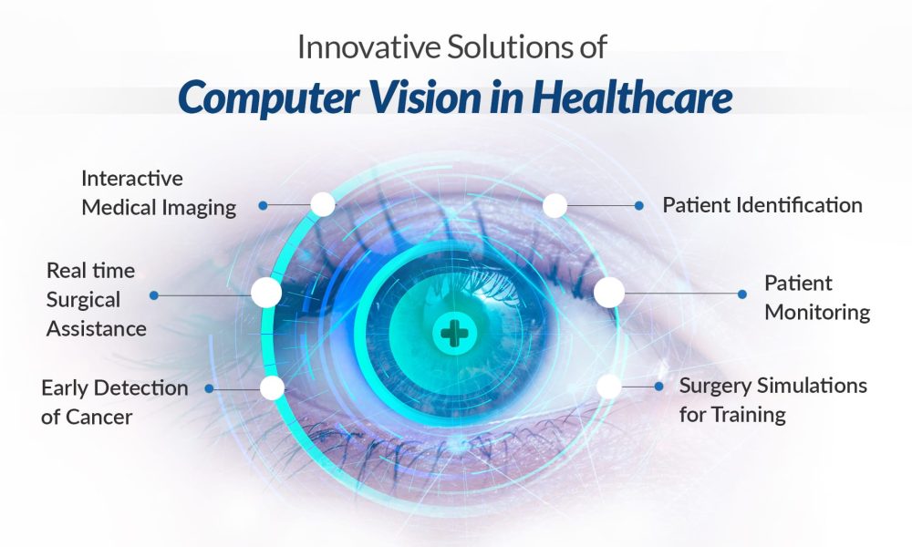 Computer Vision in Healthcare Market Report 2025-2032| NVIDIA, IBM ...