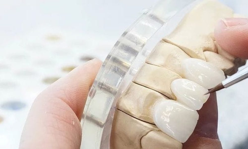 Dental Ceramic Market