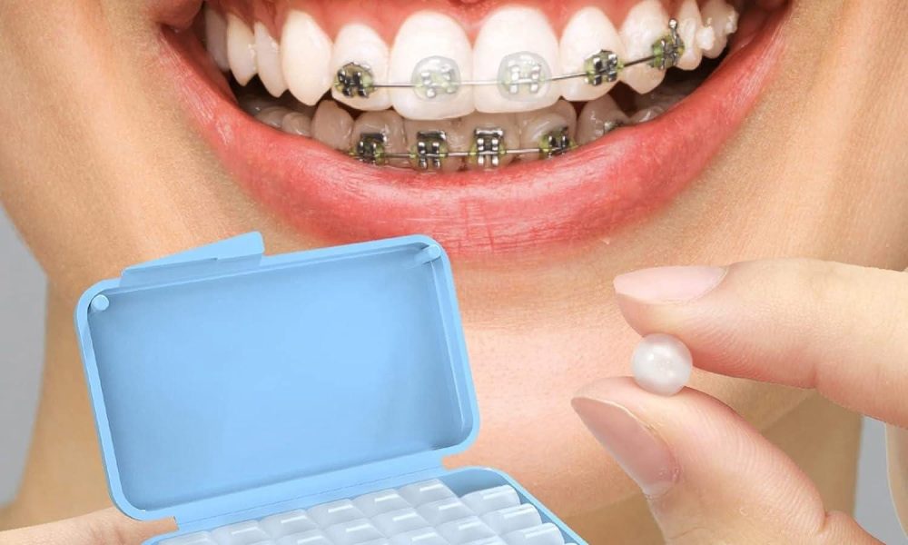 Dental Wax Market