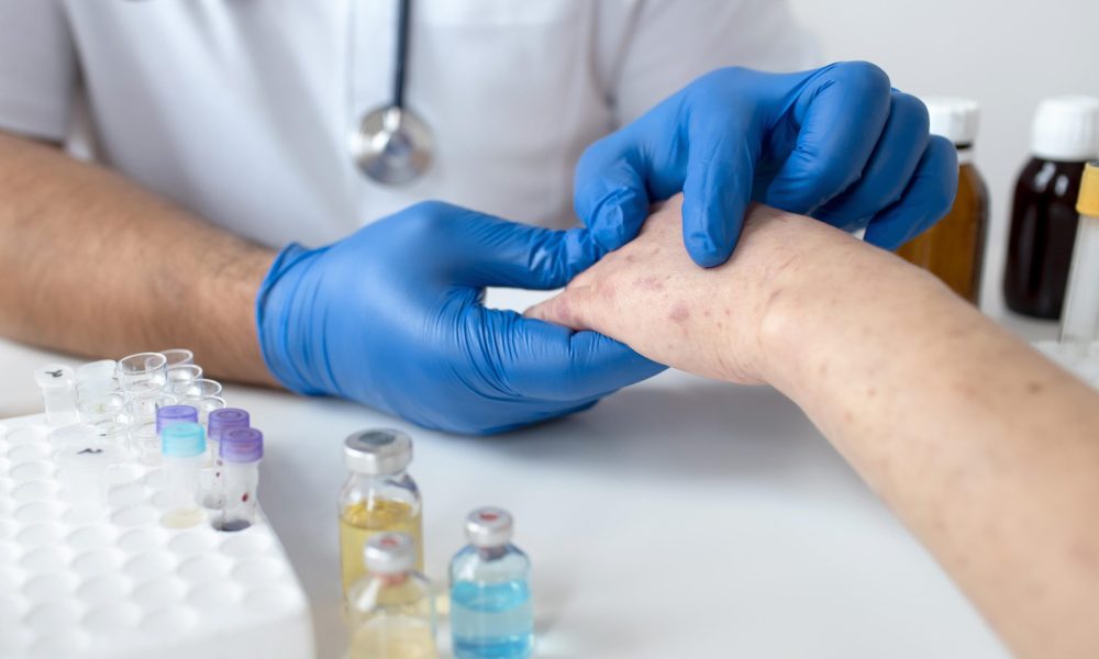 Dermatology Drug Market