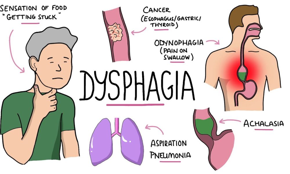 Dysphagia Supplement Market