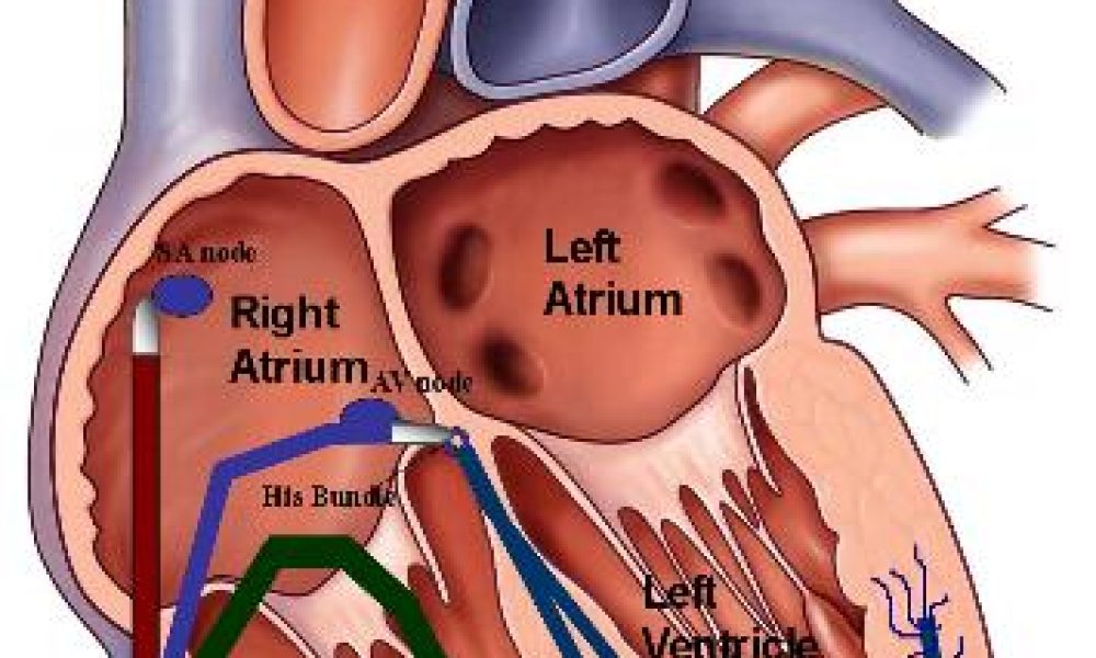 EP Catheter Ablation Market