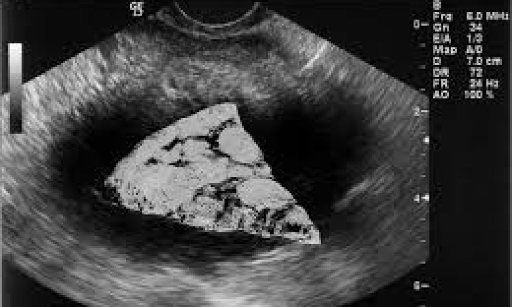 Food Ultrasound Market