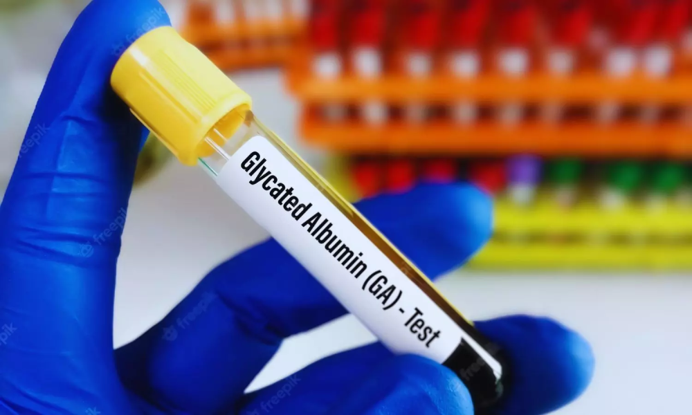 Glycated Albumin Market