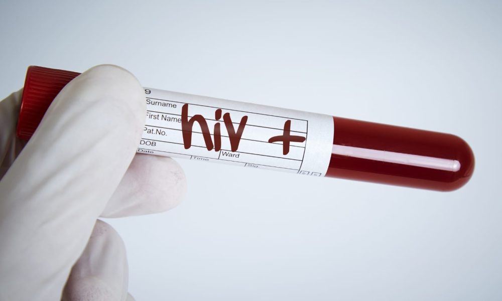 HIV Antivirals Market