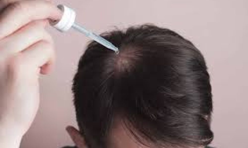 Hair Loss Medications Market