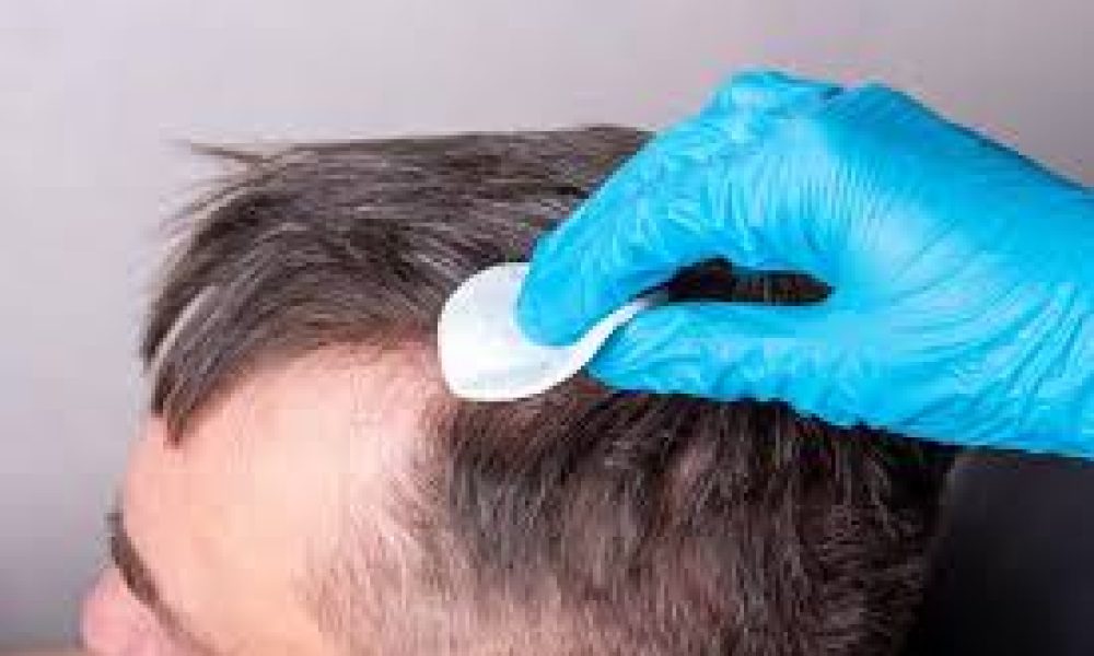 Hair Loss Prevention Product Market size