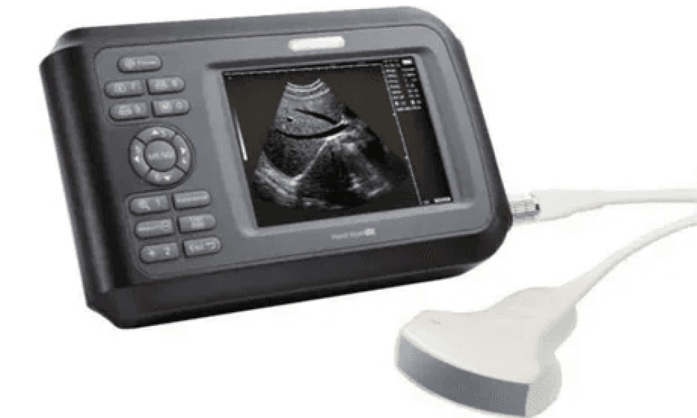Handheld Ultrasound Scanner Market