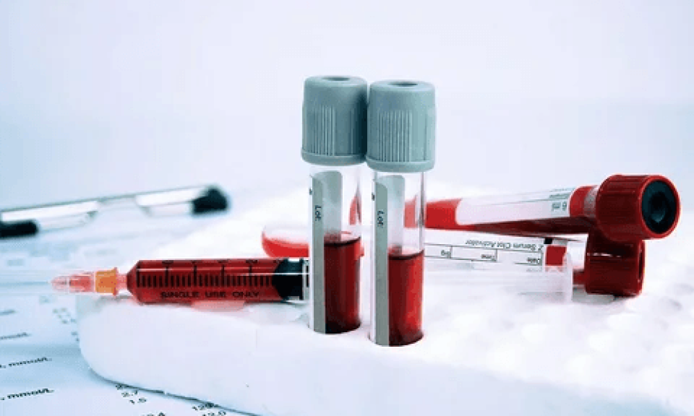 Hematology Diagnostic Market