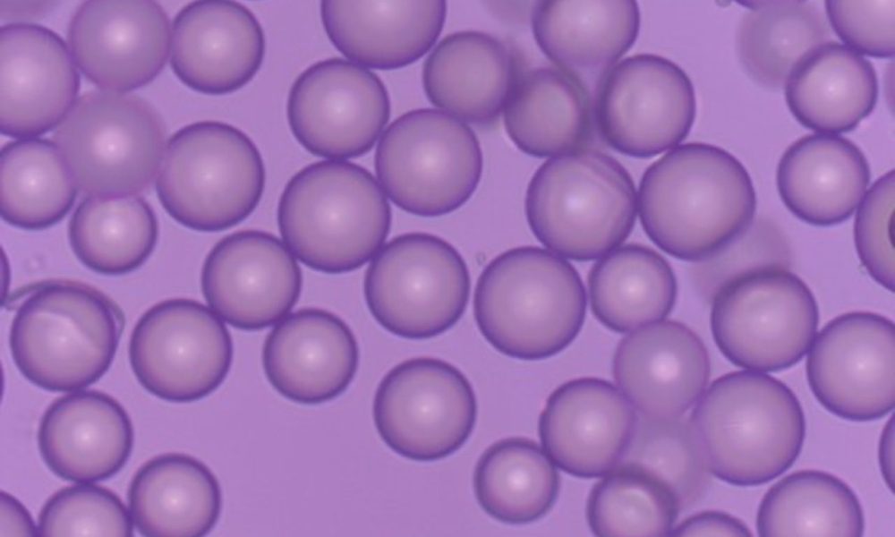 Holmium Microspheres Market1