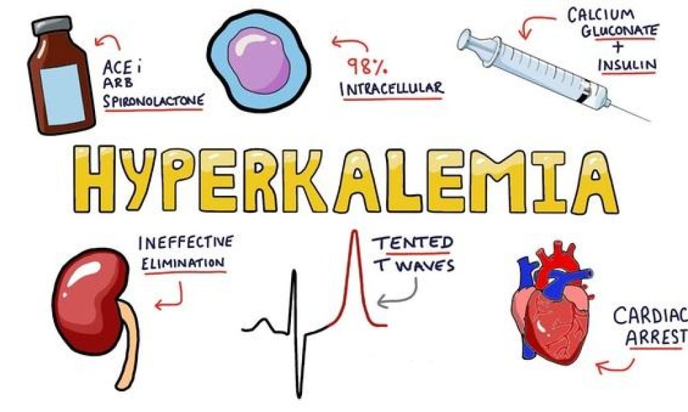 Hyperkalemia Treatment Market